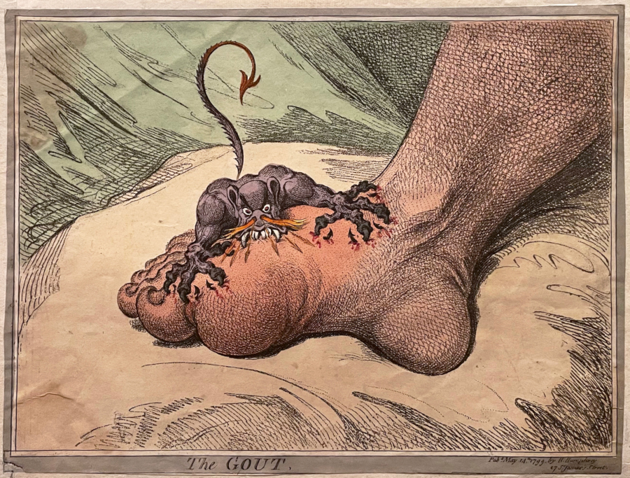 a diabolical creature taking a bite out of a swollen foot