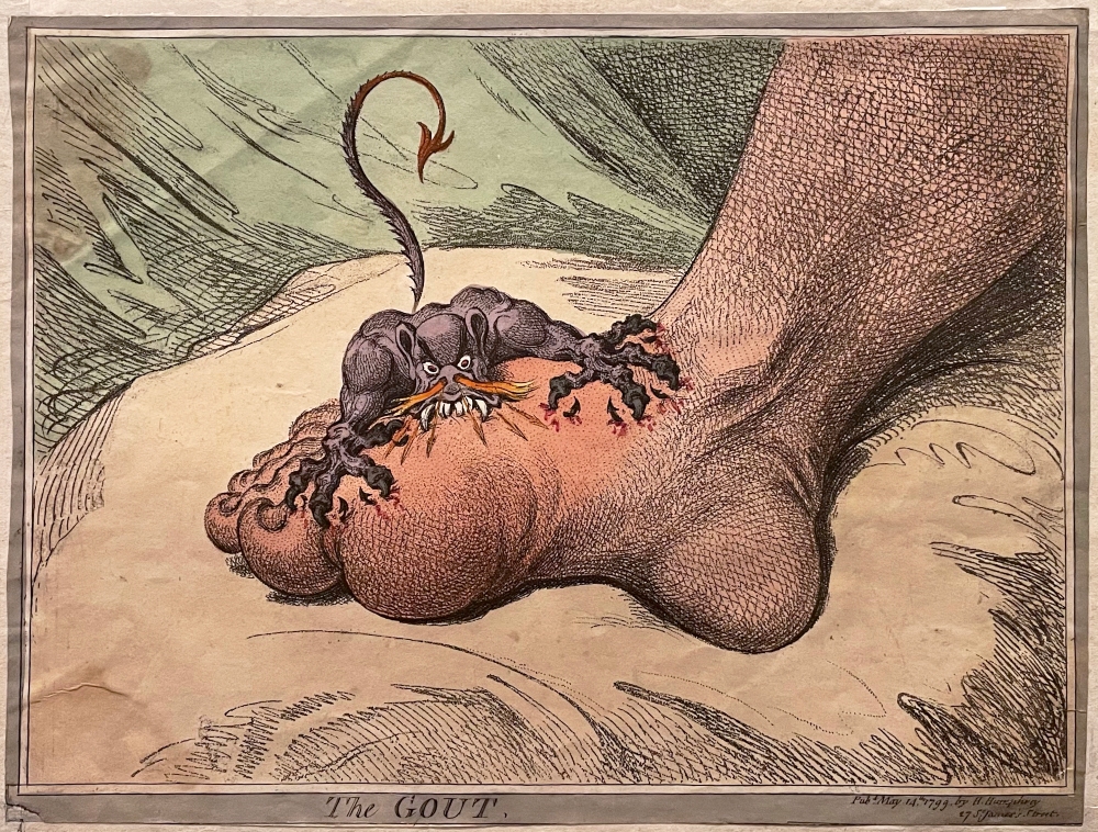 Characture of the devil biting into a foot that is swollen with gout
